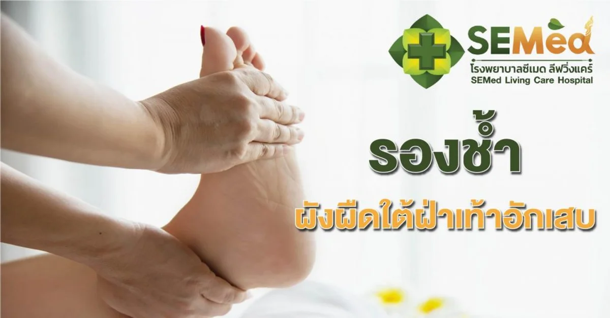 รองช้ำ หรือพังผืดใต้ฝ่าเท้าอักเสบ (Plantar fasciitis)