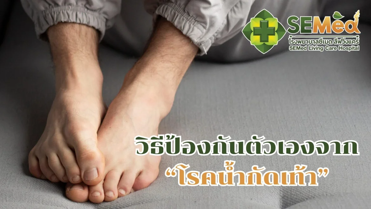 วิธีป้องกันตัวเองจาก "โรคน้ำกัดเท้า"